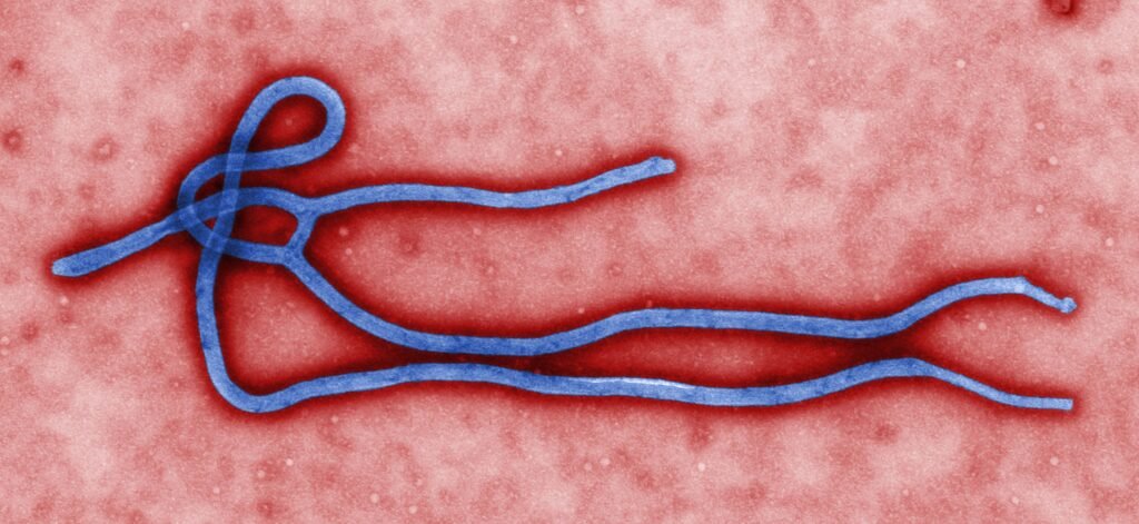 Archival colorized CDC electron micrograph of a blue Ebola virus particle against a red background; depicts Zaire ebolavirus, not the Bundibugyo strain in Kenya's 2026 outbreak.